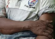 Patah Tulang dan Luka Jahit, Sopir Truk Kontainer Diperdaya OTK Salah Sasaran