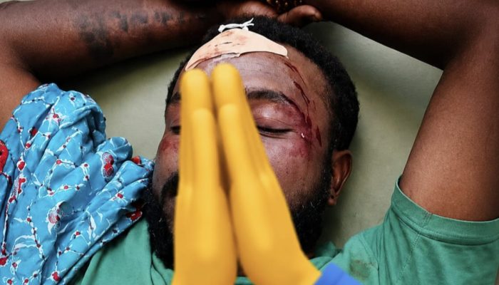 Keluarga Pasien Kecelakaan Soroti Pelayanan dan Ketersediaan Alat CT Scan di RSUD Siriwini Nabire