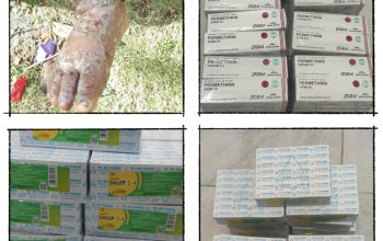 Kasus Skabies Meluas hingga Berkomplikasi Pioderma, Dinkes Papua Tengah Pastikan Obat dan Tim Medis Tetap Sampai ke Puncak Jaya